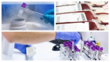 Why use RFID tag in Hospitals 